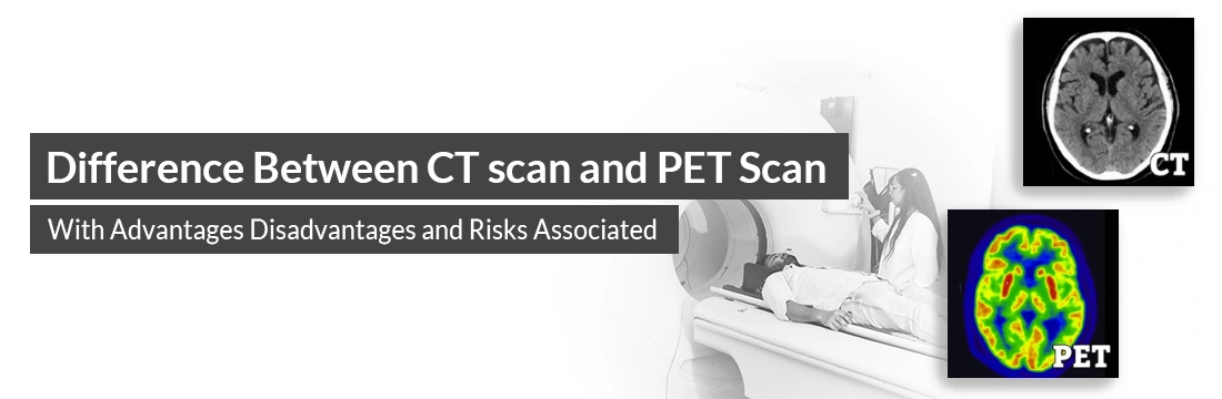 Difference Between CT Scan and PET Scan With Advantages Disadvantages and Risks Associated